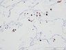Thumbnail for dataset humanlung_d7_CD68