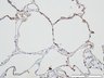 Thumbnail for dataset humanlung_d7_Cytokeratin