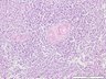 Thumbnail for dataset humanspleen_d0