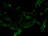 Thumbnail for 334-Hashimoto-SARSorganoid