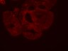 Thumbnail for 285-Tanaka-Covid19Infection