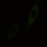 Thumbnail for 380-Wang-ActininTensionSensor
