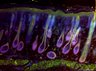 Thumbnail for 104-Bin-SkinImmuno